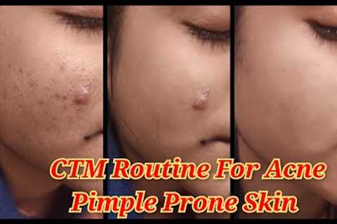 CTM Routine For Acne and Pimple Prone Skin | Oily Skin Care Routine |