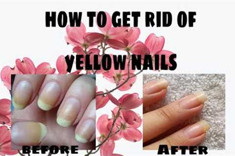 how to take care of nails