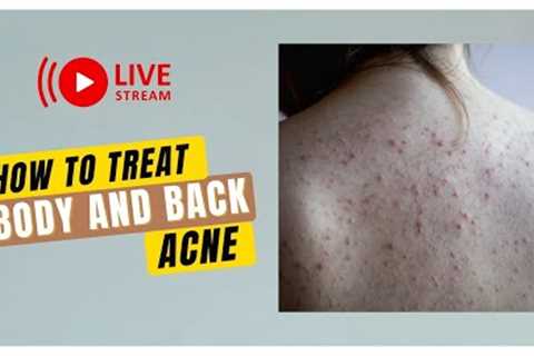 How To Treat Back and Body Acne. This''s what i did